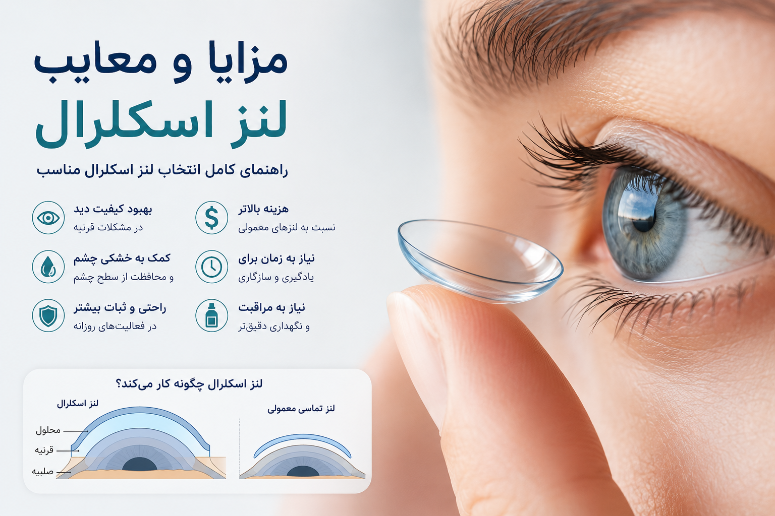 مزایا و معایب لنز اسکلرال؛ راهنمای کامل انتخاب لنز اسکلرال مناسب