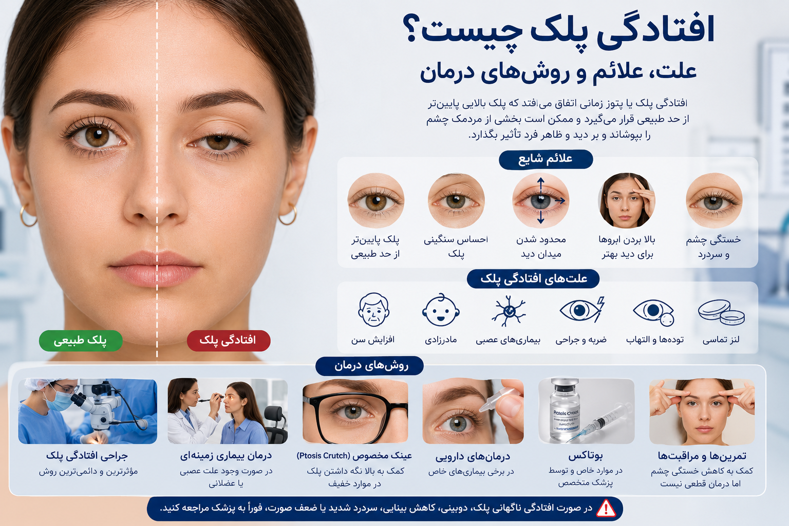 افتادگی پلک چیست؟ علت، علائم، روش‌های درمان و زمان مراجعه به پزشک