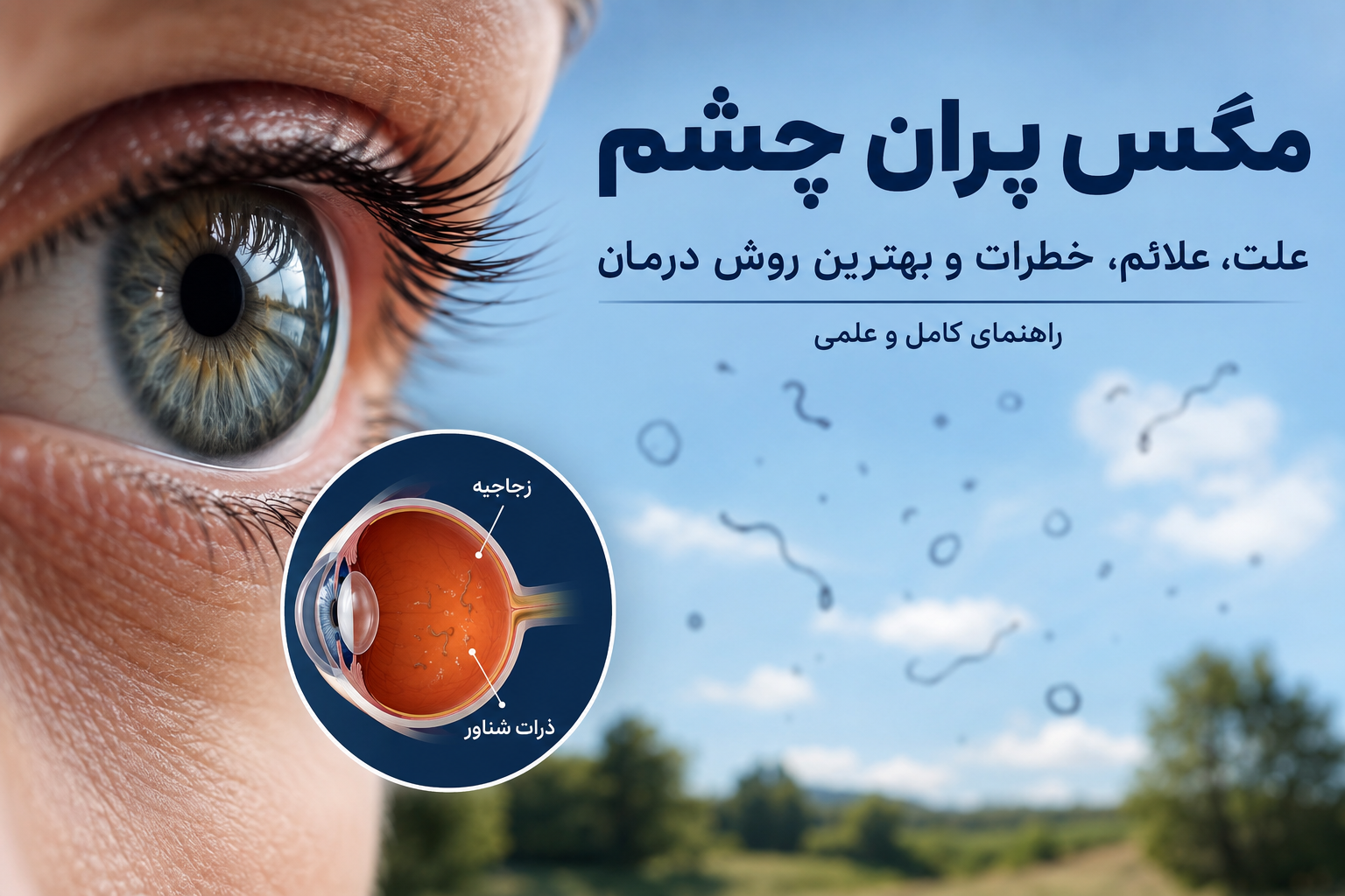 مگس پران چشم چیست؟ علت، علائم و بهترین روش درمان مگس پران